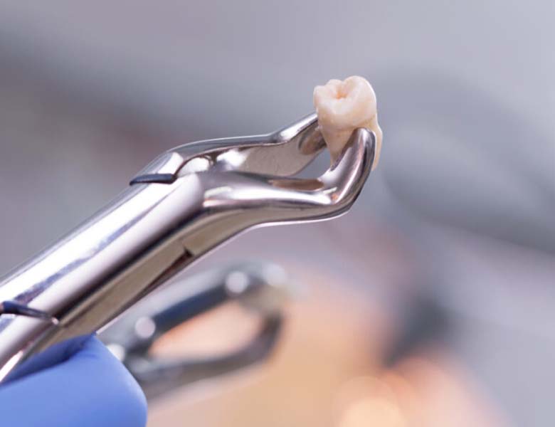 仙台市青葉区台原の歯医者、台原みなも歯科クリニックのなるべく痛くない、歯を守り、残す治療