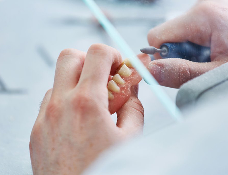 仙台市青葉区台原の歯医者、台原みなも歯科クリニックの入れ歯治療