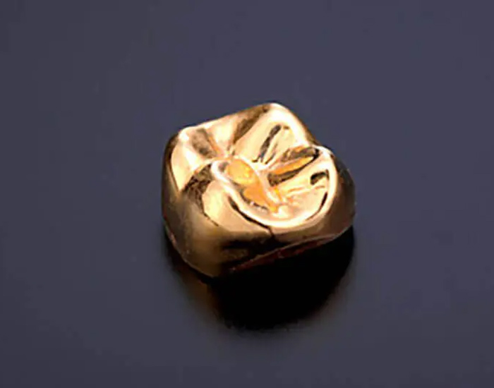 仙台市青葉区台原の歯医者、台原みなも歯科クリニックの審美歯科治療