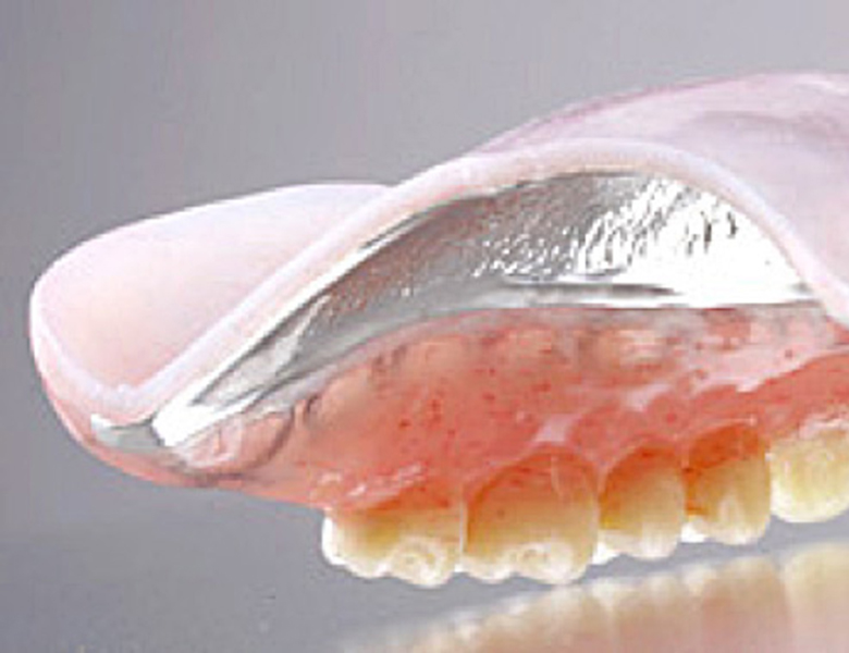 仙台市青葉区台原の歯医者、台原みなも歯科クリニックの入れ歯治療