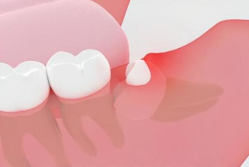 仙台市青葉区台原の歯医者、台原みなも歯科クリニックのなるべく痛くない、歯を守り、残す治療