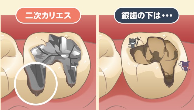 仙台市青葉区台原の歯医者、台原みなも歯科クリニックの予防歯科