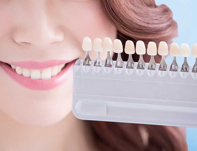 仙台市青葉区台原の歯医者、台原みなも歯科クリニックのホワイトニング