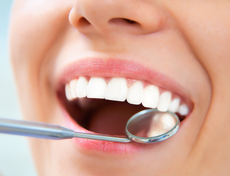 仙台市青葉区台原の歯医者、台原みなも歯科クリニックの予防歯科