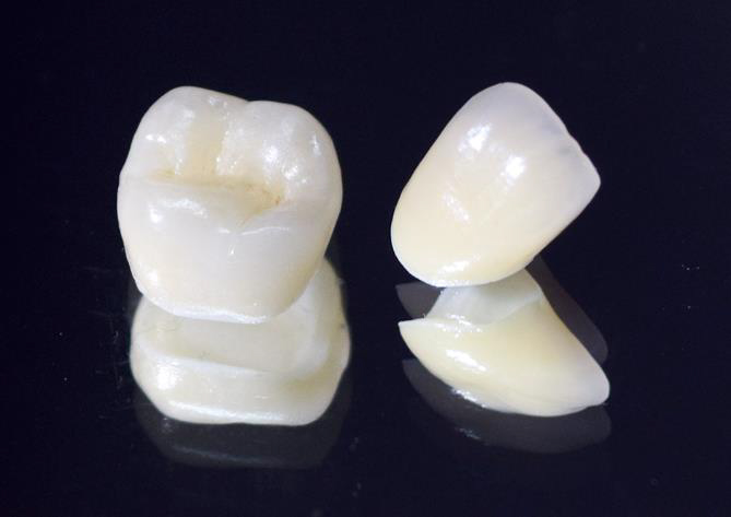 仙台市青葉区台原の歯医者、台原みなも歯科クリニックの審美歯科治療